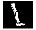 CT Single Leg Scan