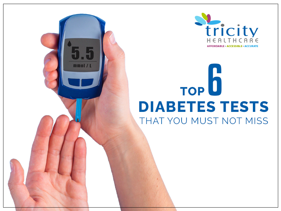 Top 6 Diabetes Tests That You Must Not Miss