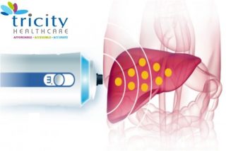 Fibroscan