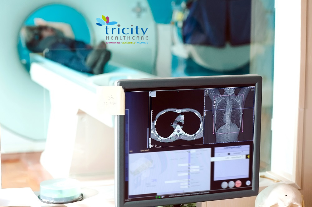PET Scan Chandigarh - Tricity Healthcare